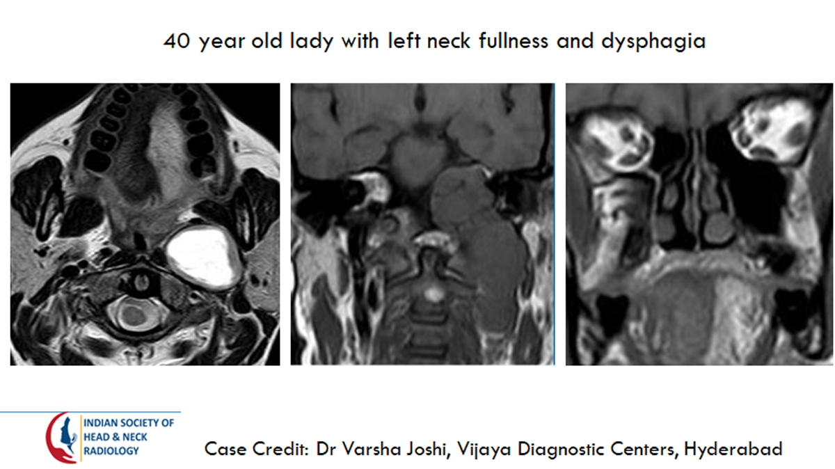 Case 1 Images