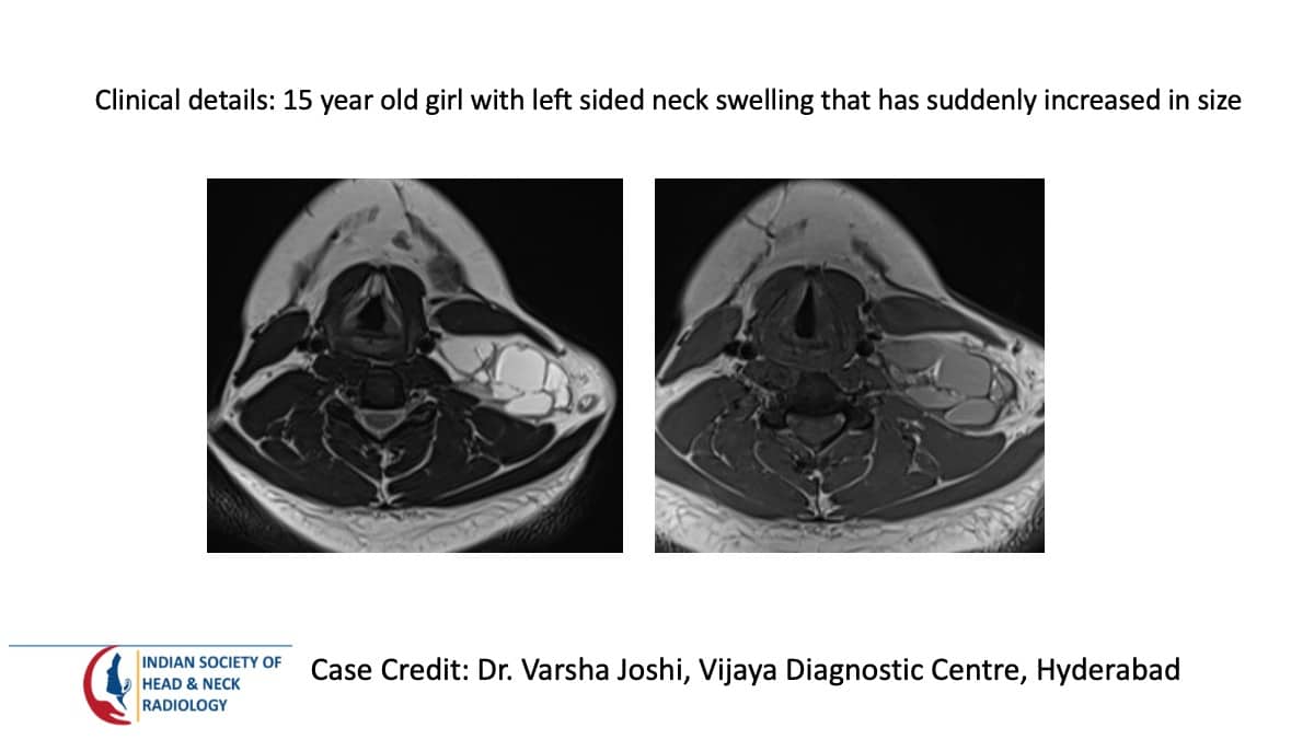 Case 5 Images