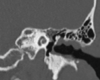 MRI Scan Analysis