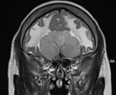 Temporal Scan Analysis