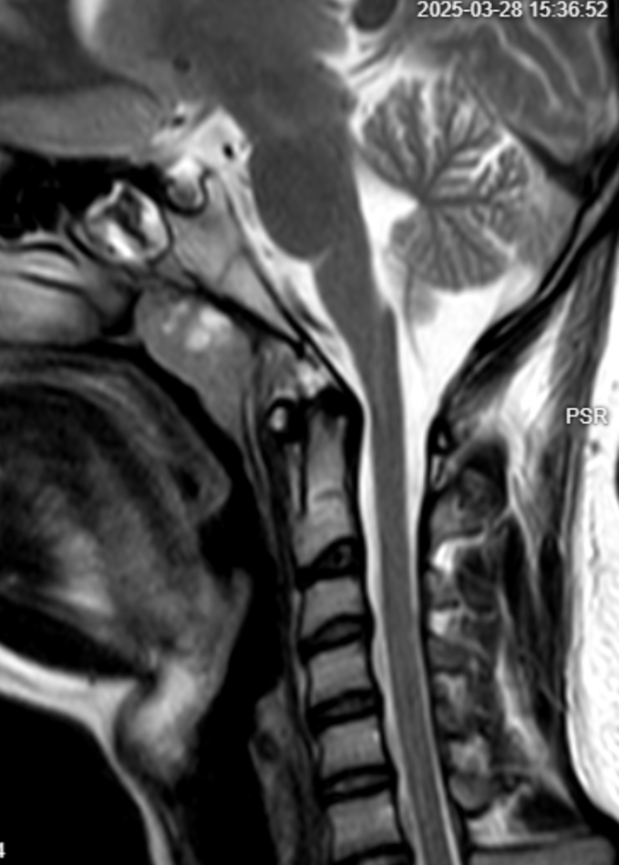 CT Scan Analysis