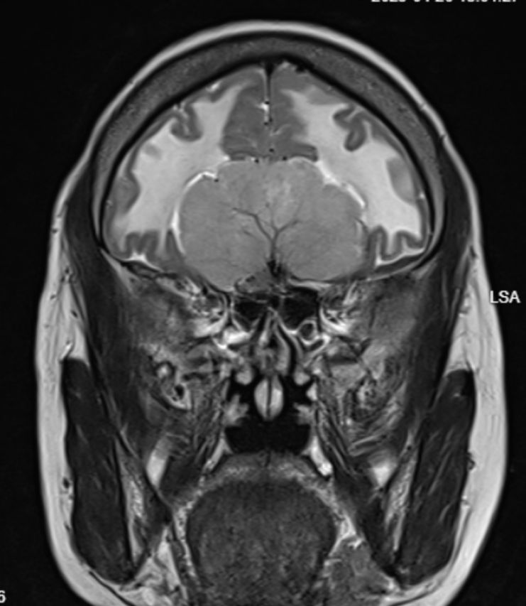 Temporal Scan Analysis